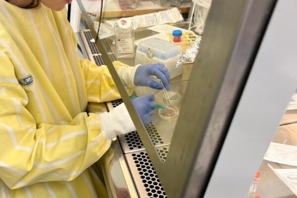 Extracellular Vesicle Biomarker Technologies