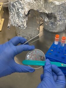 TWINFLAG extracellular vesicle biomarker technologies